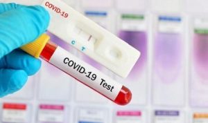 AJI-IJTI Lampung Kecam Rapid Test Khusus Wartawan