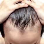 5 Bahan Alami Untuk Mencegah Kebotakan