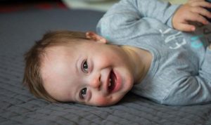 Penyebab Anak Down Syndrome dan Cara Mendeteksinya